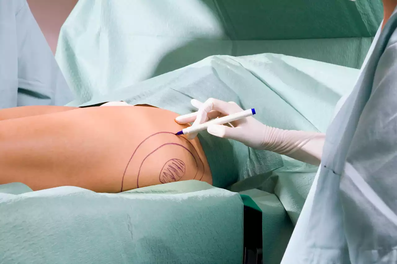 How Remote Work and Social Media Are Creating a Plastic Surgery Boom