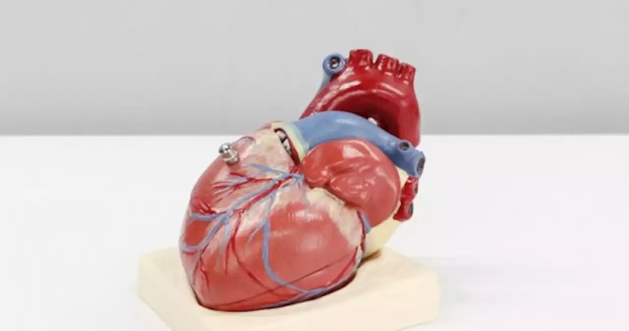 Covid-19 patients are more likely to develop heart problems - even a year later, study finds