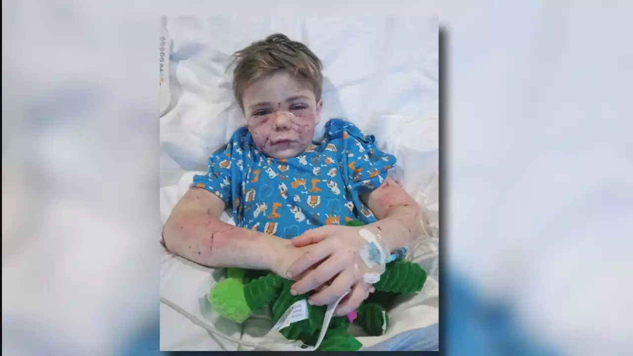 Azle 7-year-old nearly mauled to death by neighbor's dog