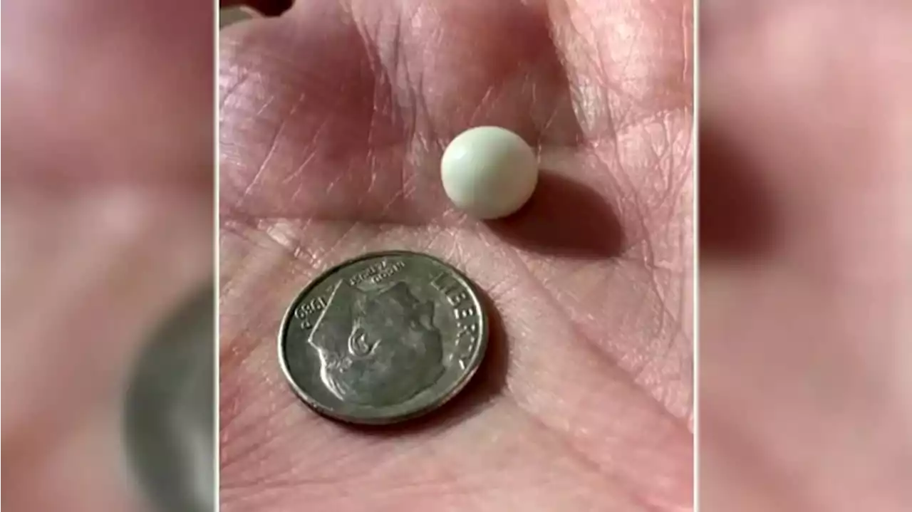 Couple finds pearl worth thousands of dollars in clam dinner at seafood restaurant