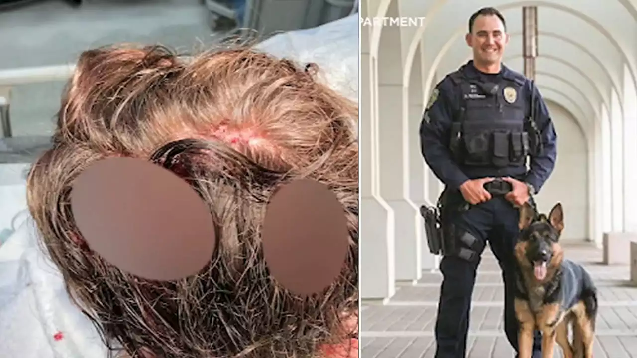 Bay Area police dog that ripped off woman's scalp had similar bite in 2019