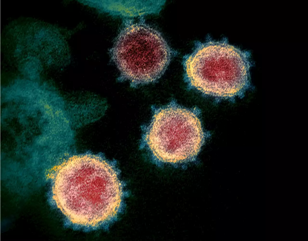 Variant that combines Delta and Omicron identified; Future variants-of-concern likely lurk in today's patients