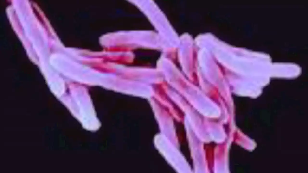 Health officials looking into possible TB exposure after active case at Seattle school