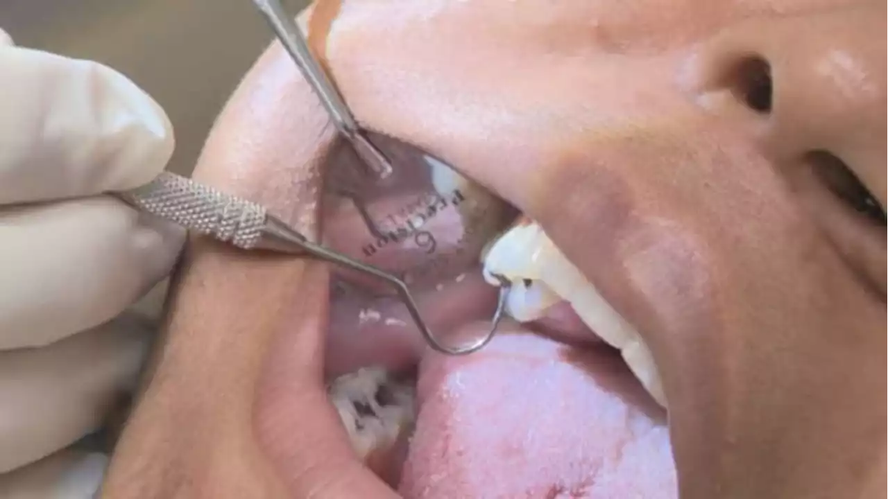 Registration opens Thursday for free dental care clinic this weekend in Orange Park