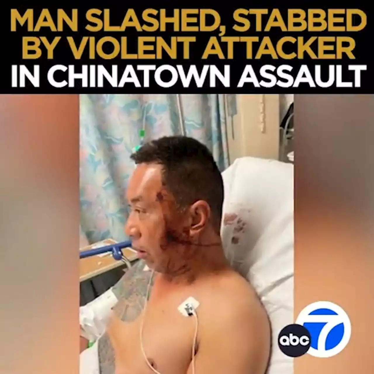 Man brutally stabbed more than 10 times while walking to store in Chinatown, family says