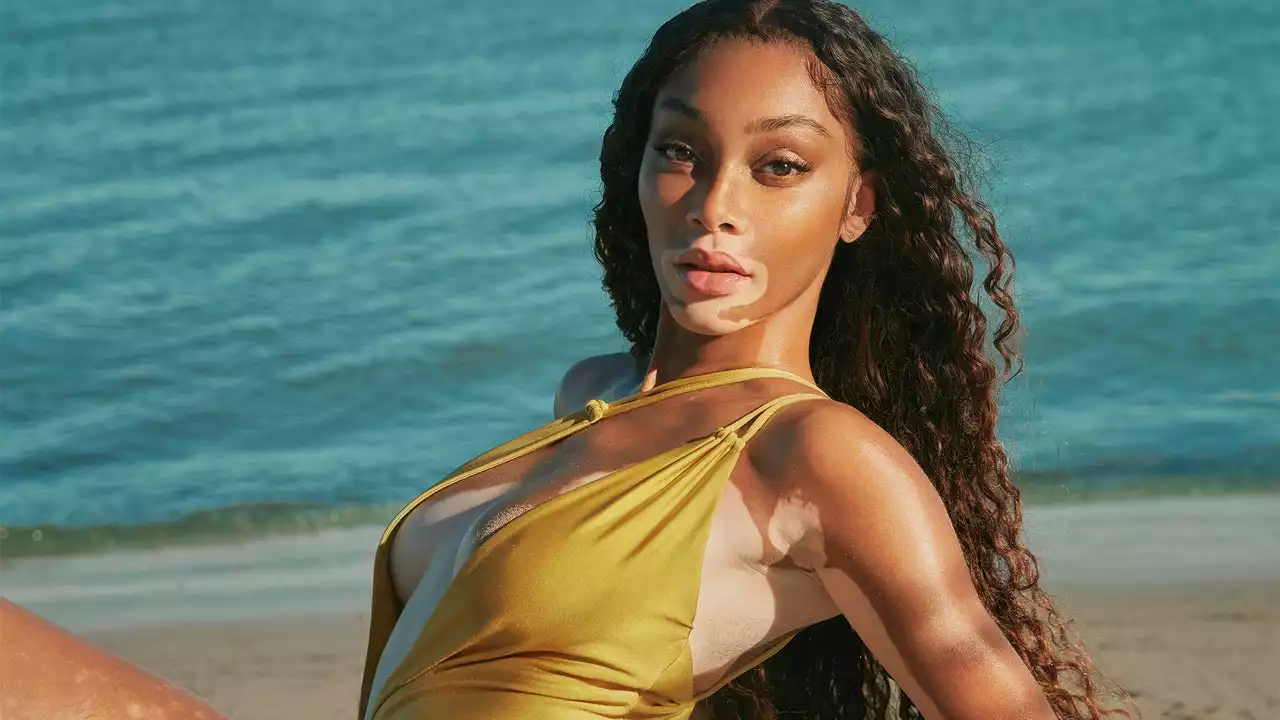 Winnie Harlow on Creating Sunscreen for All, Inspired by Her Jamaican Roots