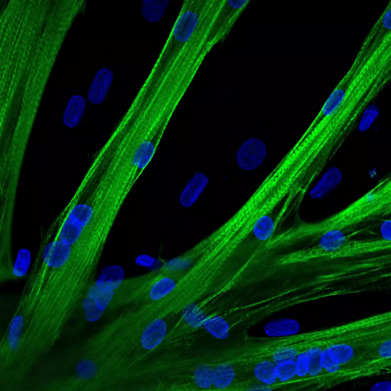 A potential therapy for muscular dystrophy: Using mRNA delivery to improve muscle strength