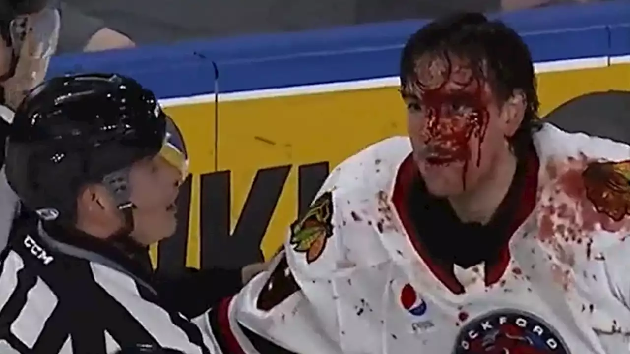 Minor League Hockey Player Left A Bloody Mess After Violent On-Ice Fight