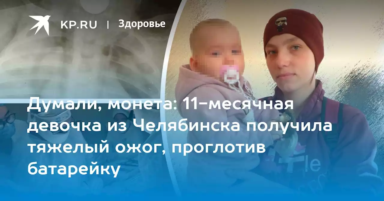Думали, монета: 11-месячная девочка из Челябинска получила тяжелый ожог, проглотив батарейку