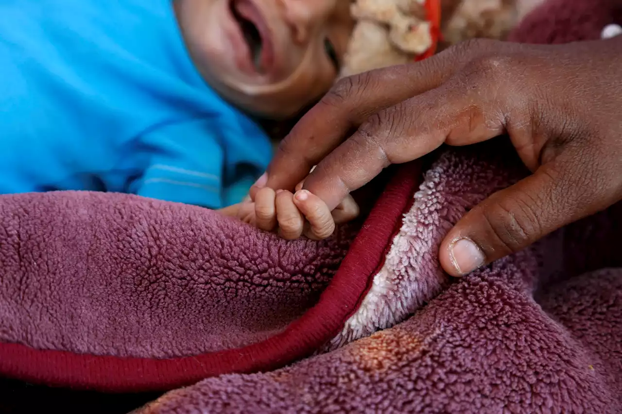 'Harrowing Figures': Report Says 161,000 Yemeni People Are Facing Famine