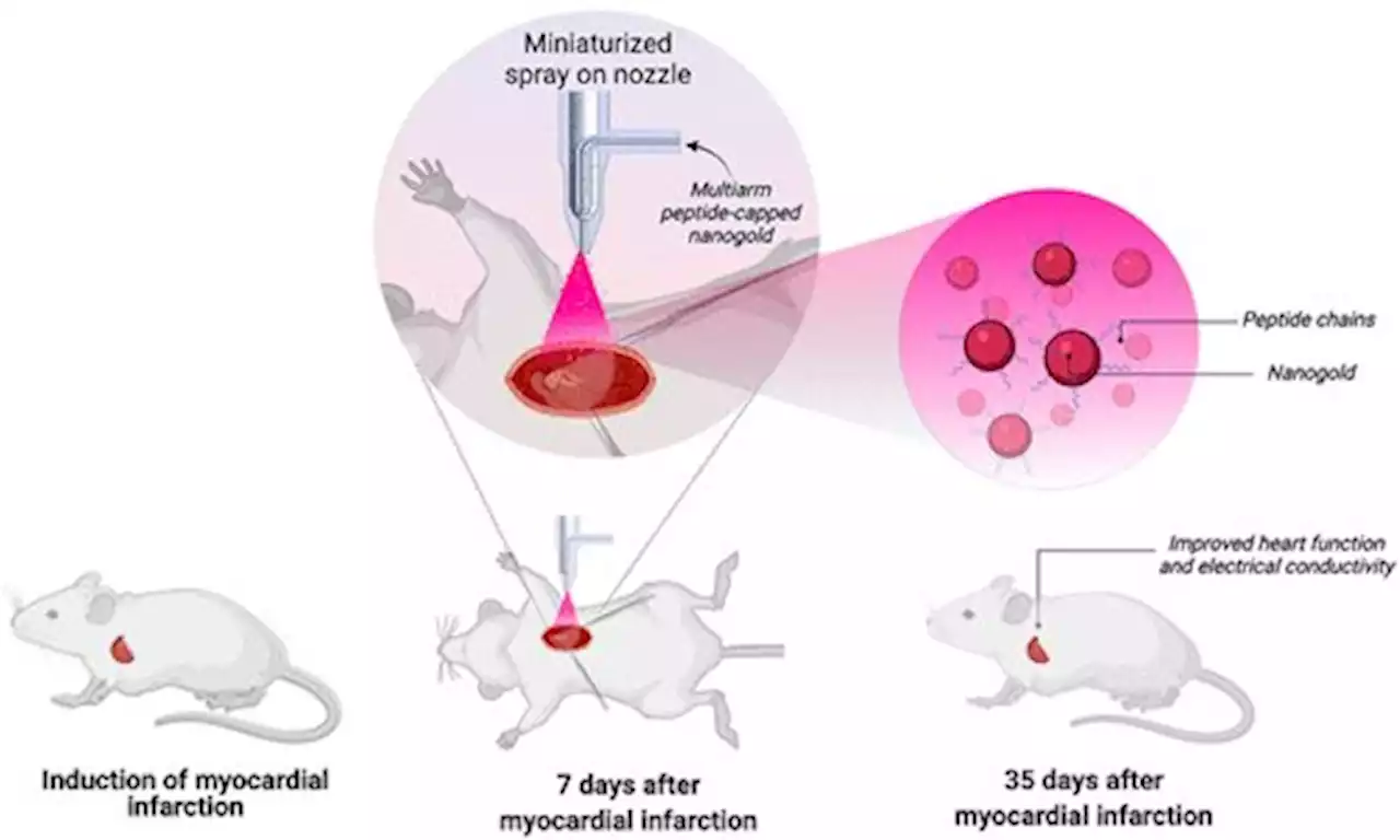 Spray of tiny particles of gold can potentially treat heart disease, research suggests