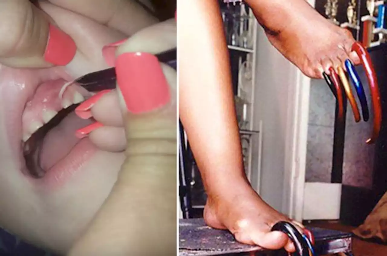 17 Times Finger And Toe Nails Went Really, Really Far