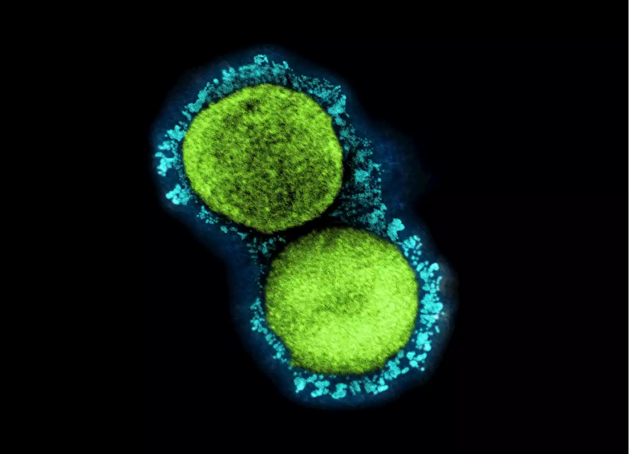 Omicron Subvariant BA.2 Now Accounts For Nearly 25% Of New U.S. Covid Cases Being Sequenced