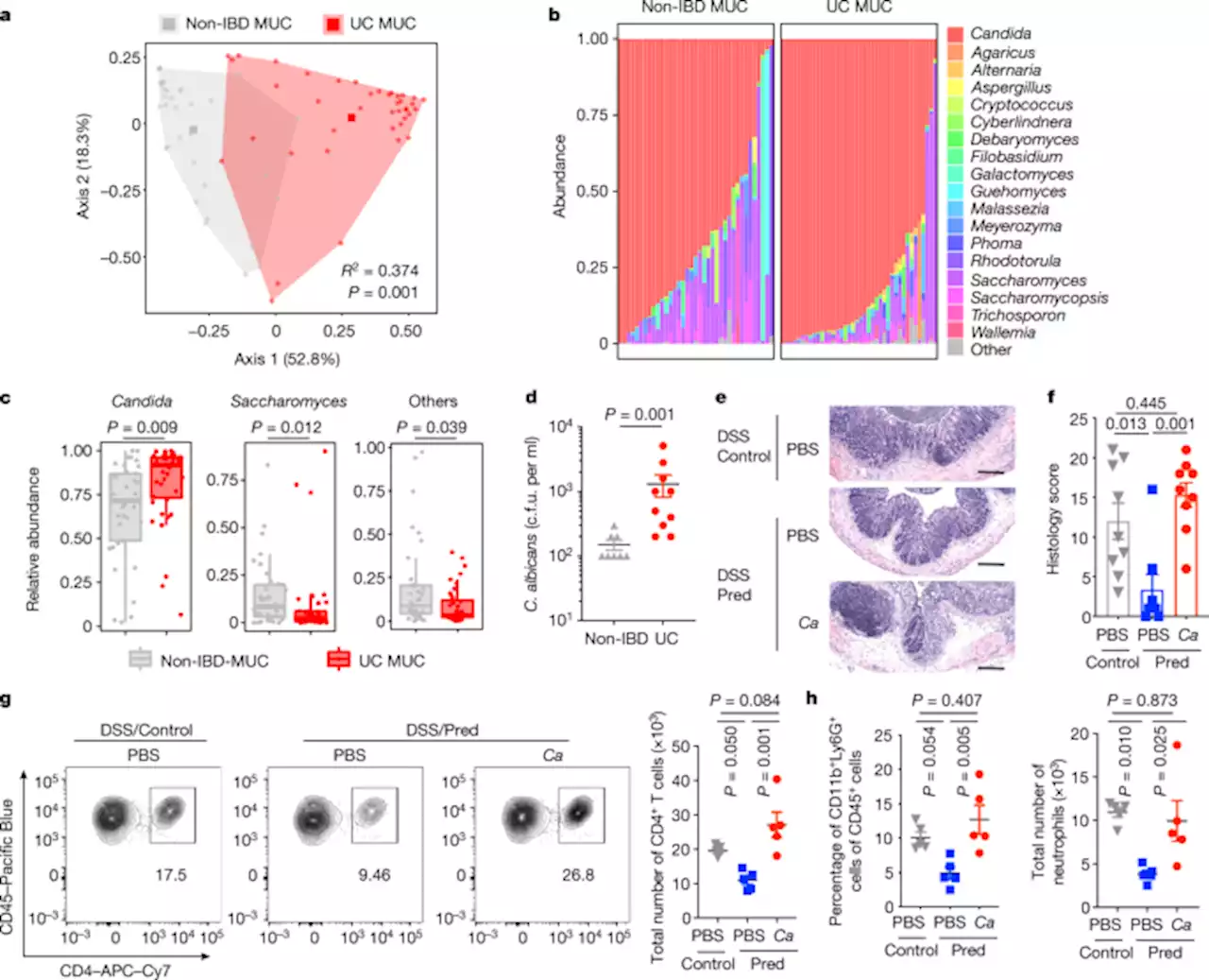 Immune regulation by fungal strain diversity in inflammatory bowel disease - Nature