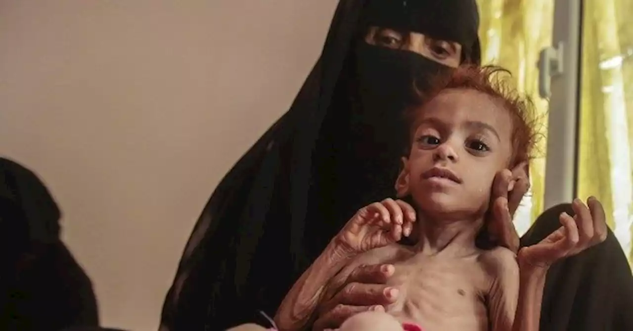 UNICEF: Victims of Yemen War Famine May Increase Five-Fold by June