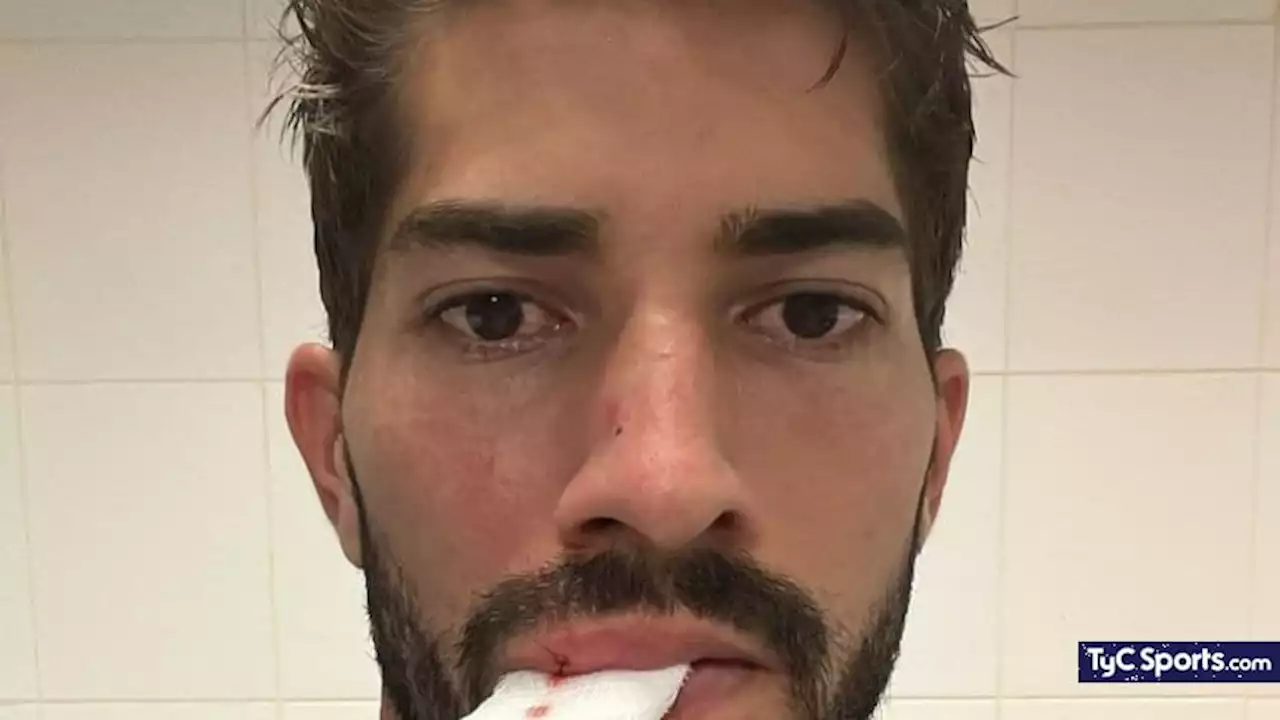 Tres puntos de sutura y un labio roto por un golpe con un celular en Brasil - TyC Sports