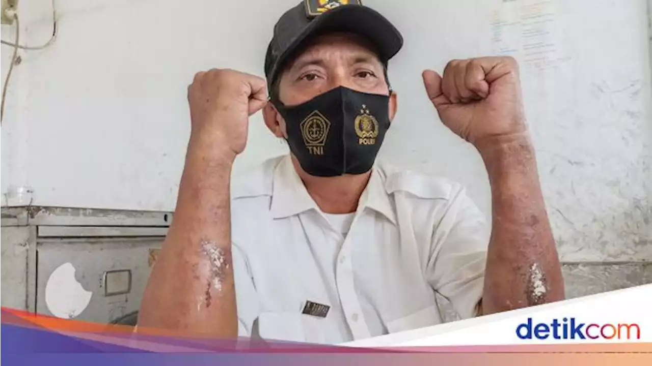 Polusi Batu Bara di Marunda, 13 Warga Keluhkan ISPA-9 Radang Kulit