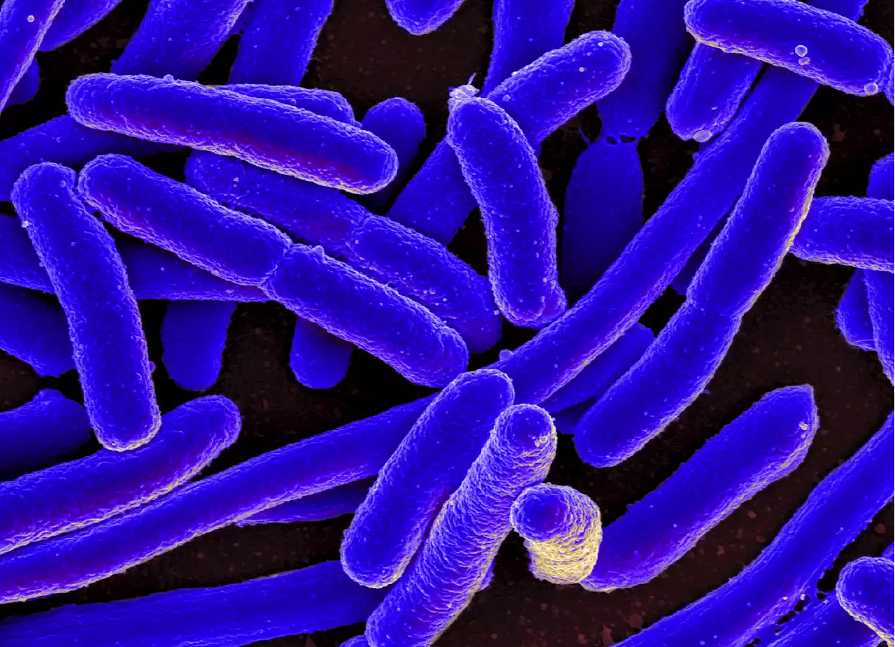 Study provides clues on why some bad infections persist