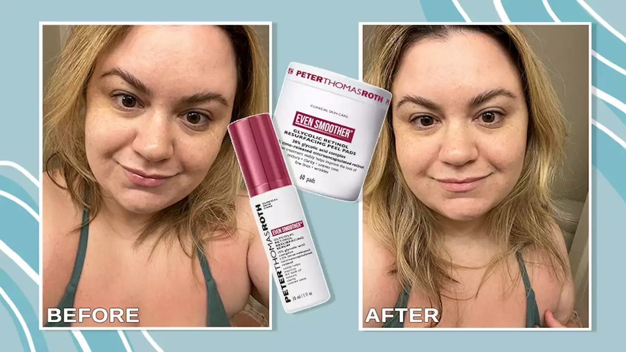 Peter Thomas Roth’s Even Smoother Line Improved My Skin Texture Dramatically Without Irritation