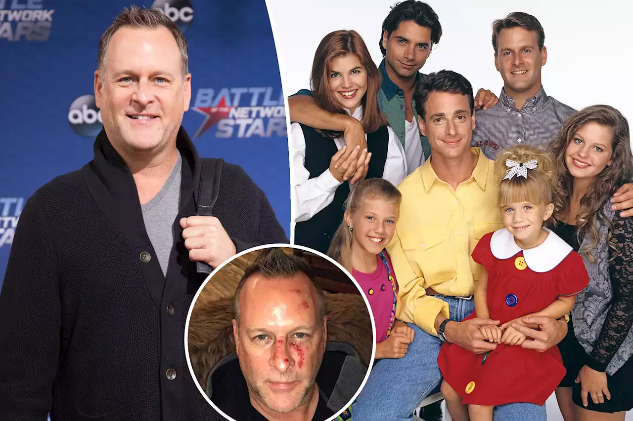 Dave Coulier's 'Full House' co-stars support him after sobriety reveal