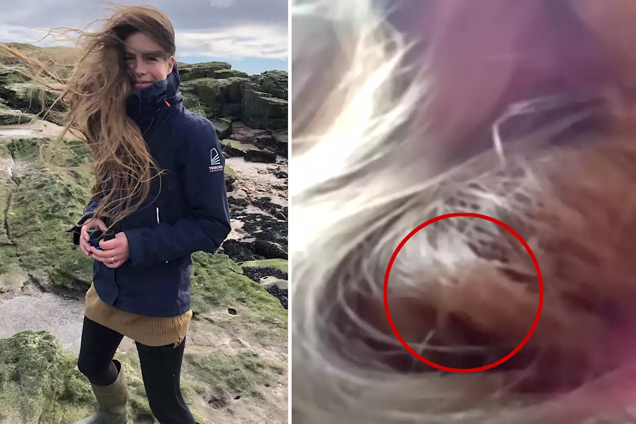 Tiny bird, abandoned by flock, nests in UK woman’s hair for 84 days