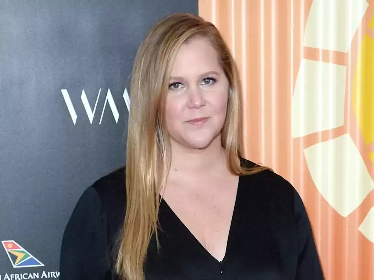 Amy Schumer Bravely Opens Up About Her Struggle With A Hair Pulling Disorder And Is Afraid Her Son