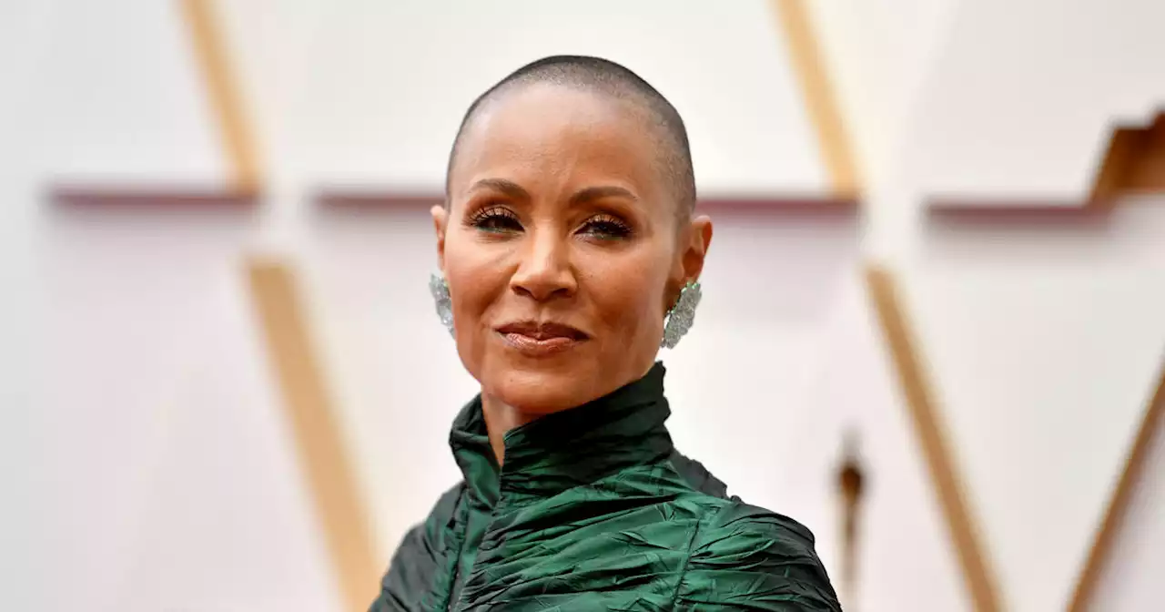 What is alopecia? Jada Pinkett Smith's experience brings public awareness to disease