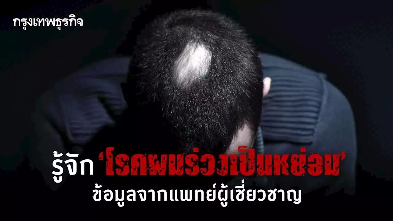 รู้จัก 'โรคผมร่วงเป็นหย่อม' โรคที่ไม่ควรถูกล้อเลียน