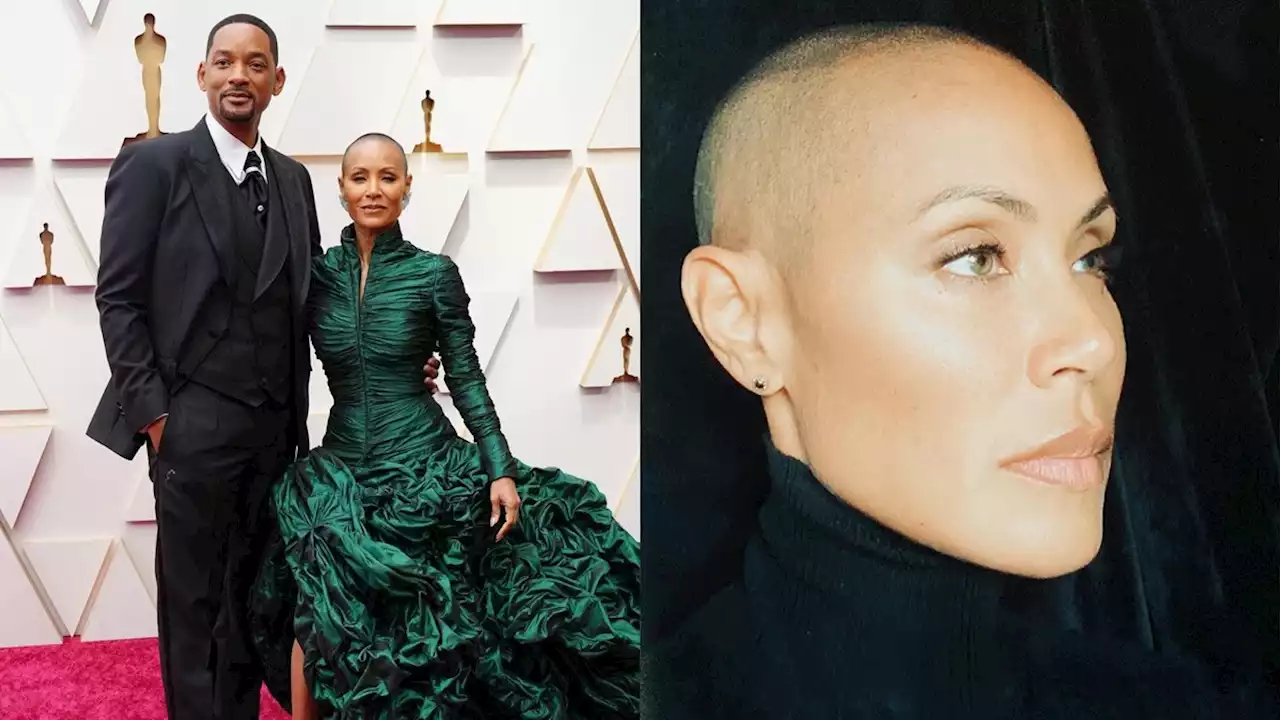 Jada Smith ผ่านการต่อสู้ความเจ็บปวดจิตใจ กว่าจะมายืนอยู่ในลุค หัวโล้นแล้วยิ้มอย่างมั่นใจได้