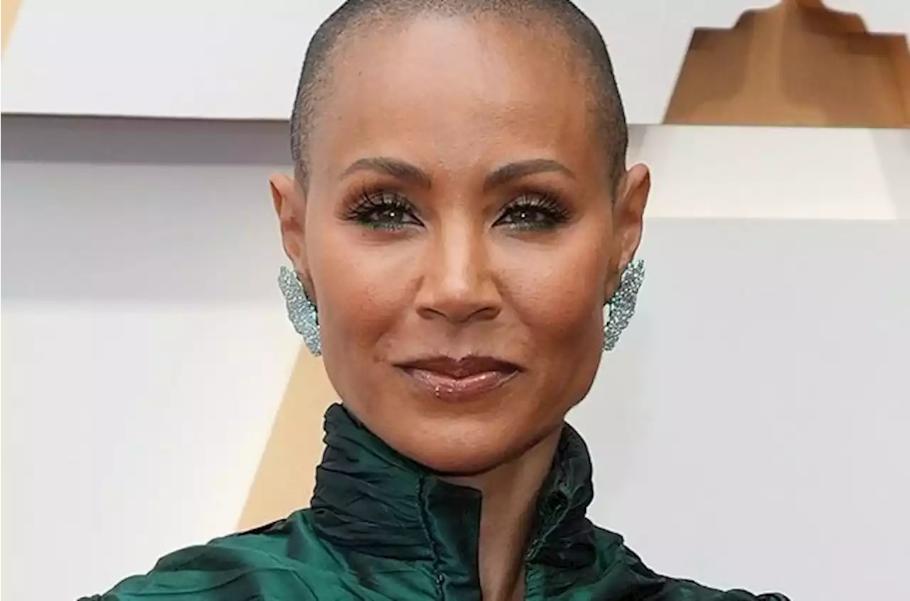 Hair loss in women: Celebrities speak of the pain of going bald | W24