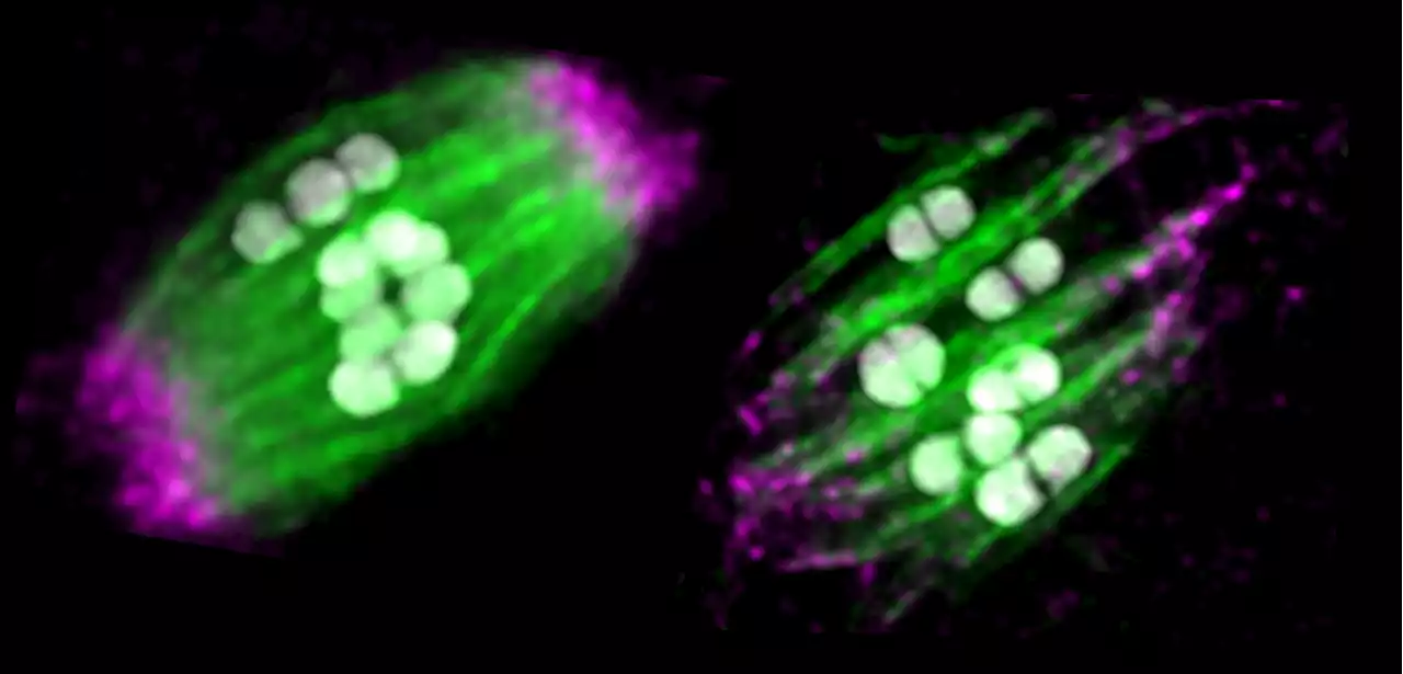 Roundworms' egg cells have a backup plan to protect against division errors