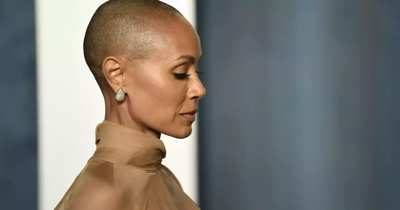 Central Indiana dermatologist shares information on alopecia after Jada Pinkett Smith joke at the Oscars