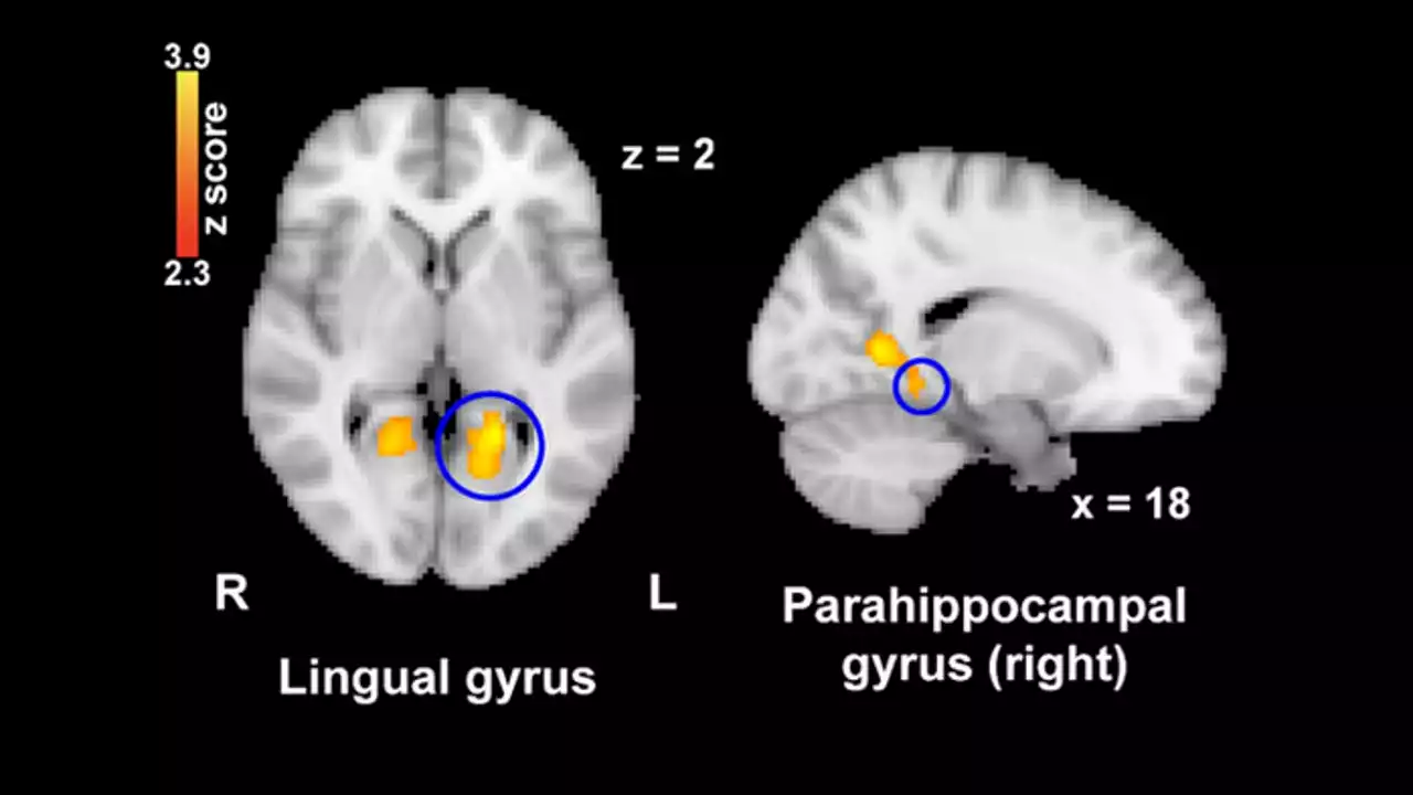 Nostalgia may help reduce our perception of pain, study shows