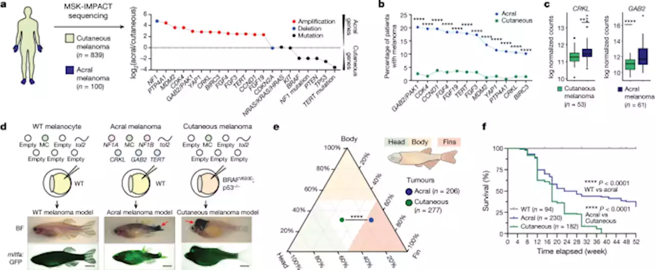 Anatomic position determines oncogenic specificity in melanoma - Nature