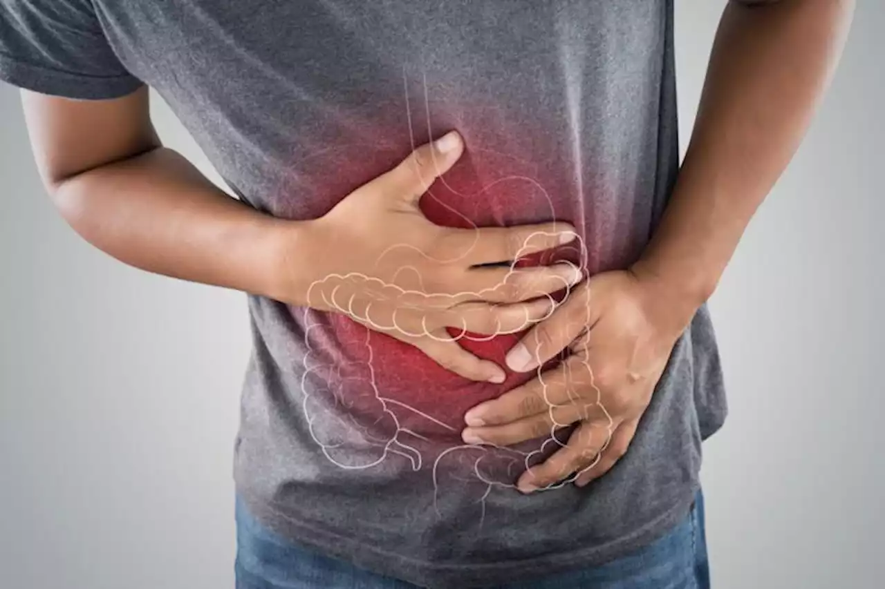 Colorectal cancer screening: What is it, why you should go and common myths debunked