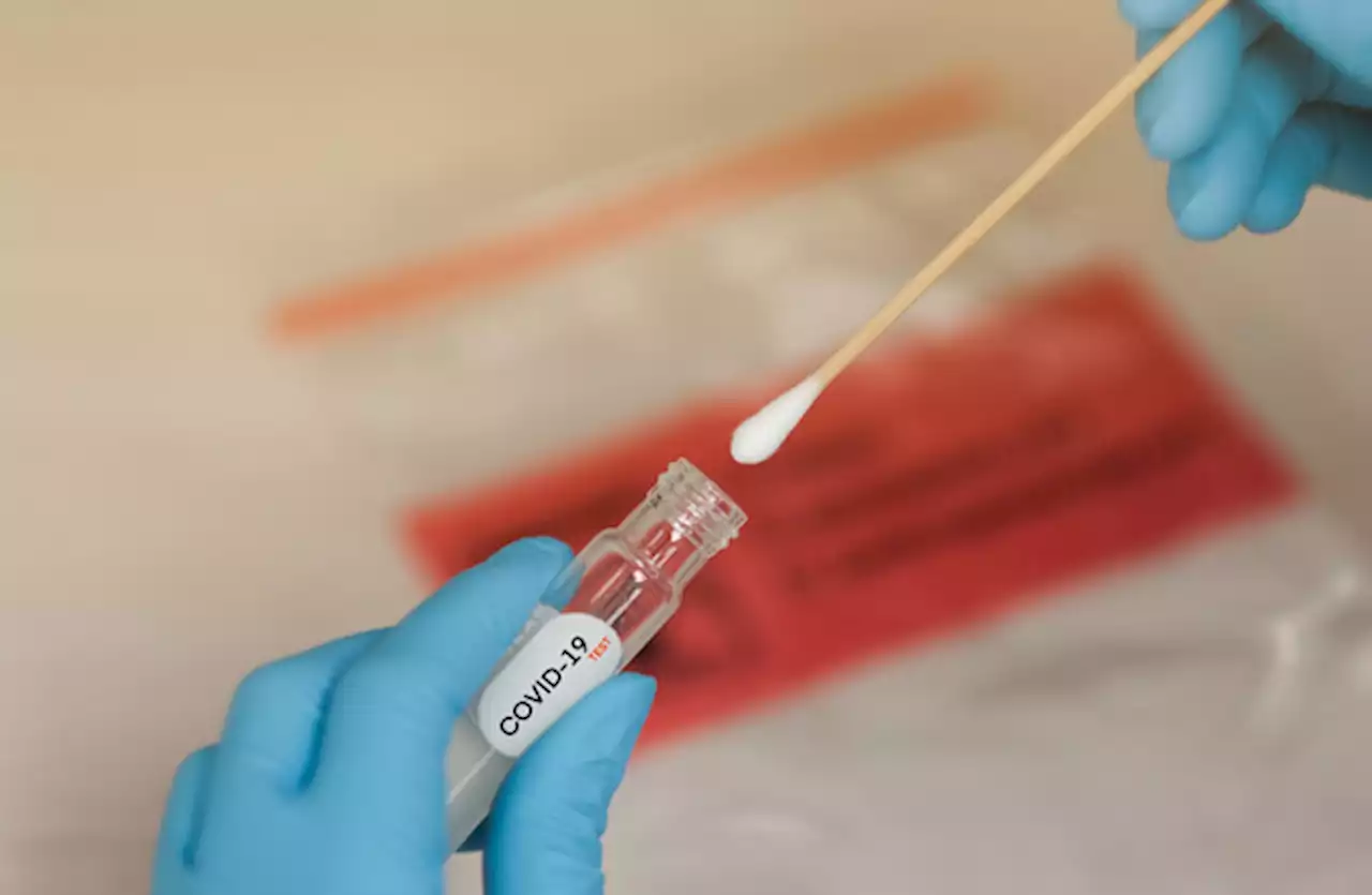 Coronavirus: 11,741 new cases and 1,535 patients in hospital, including 58 in ICU