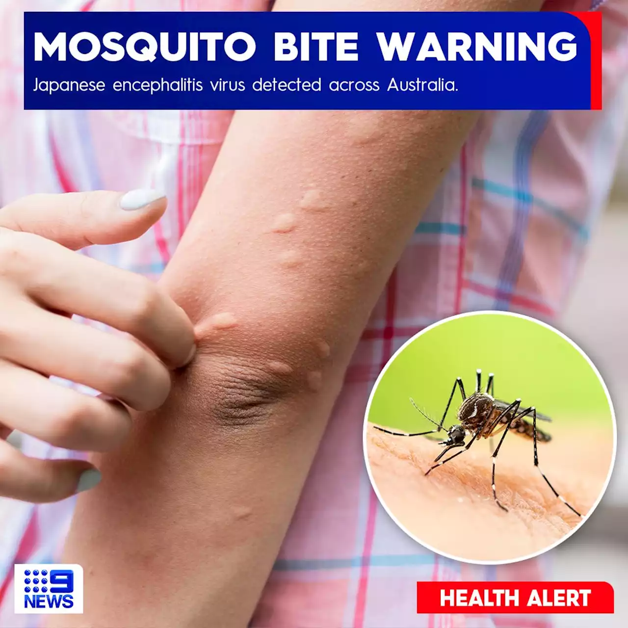 Fears of Japanese encephalitis virus spread after Queensland case diagnosed