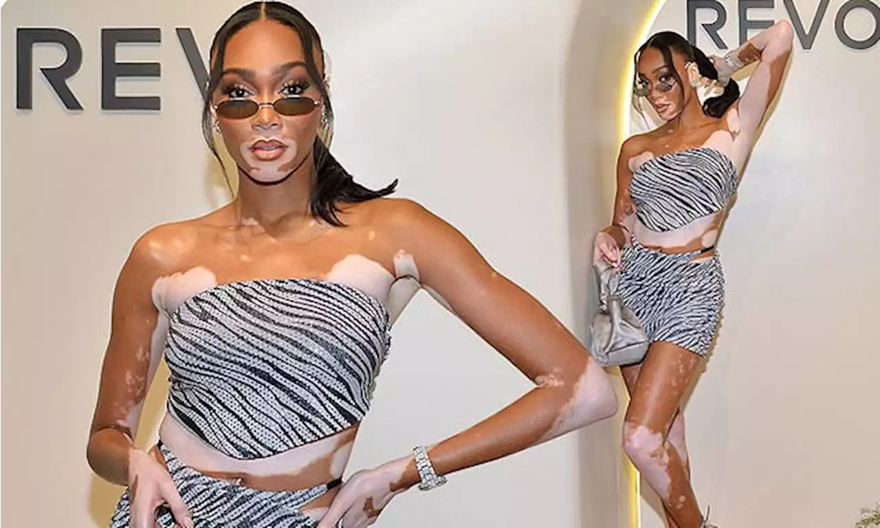 Winnie Harlow puts on leggy display in zebra top and mini skirt