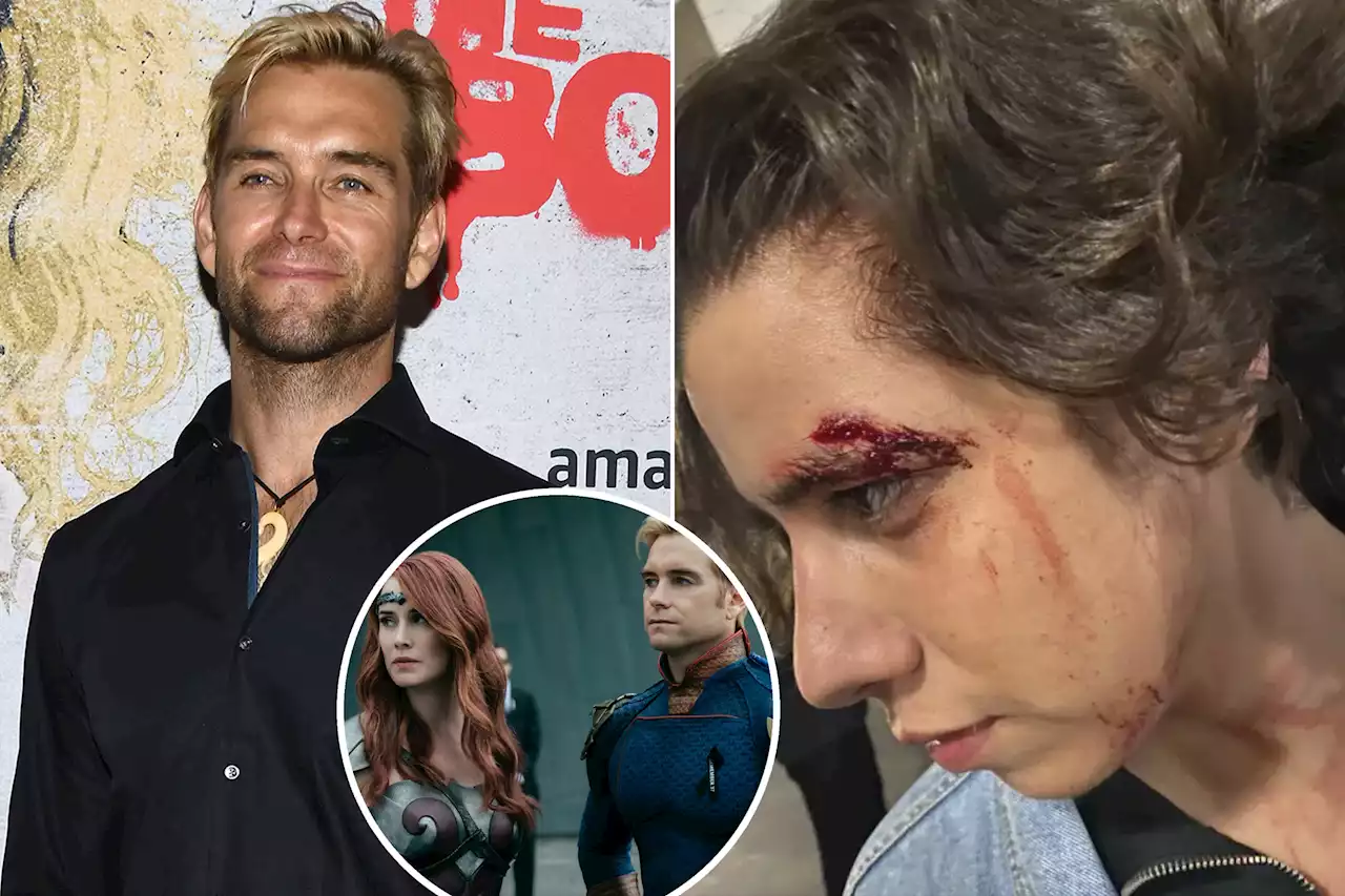 Antony Starr of ‘The Boys’ given suspended prison sentence for chef attack