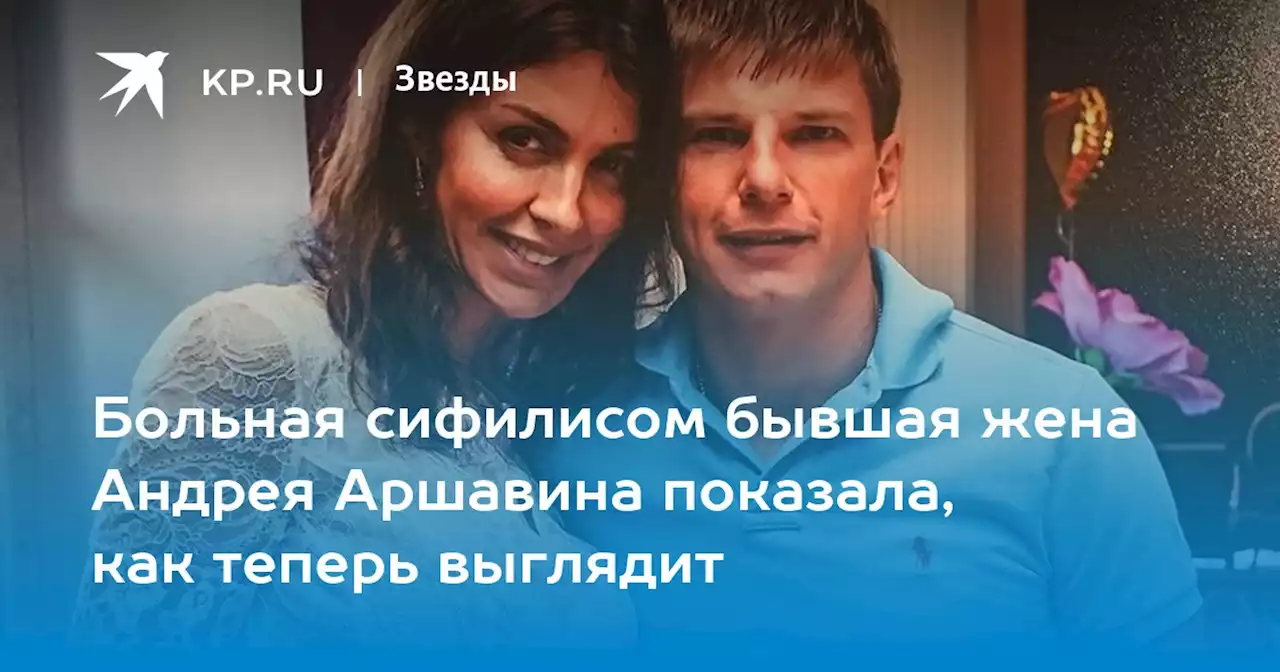 Больная сифилисом бывшая жена Андрея Аршавина показала, как теперь выглядит