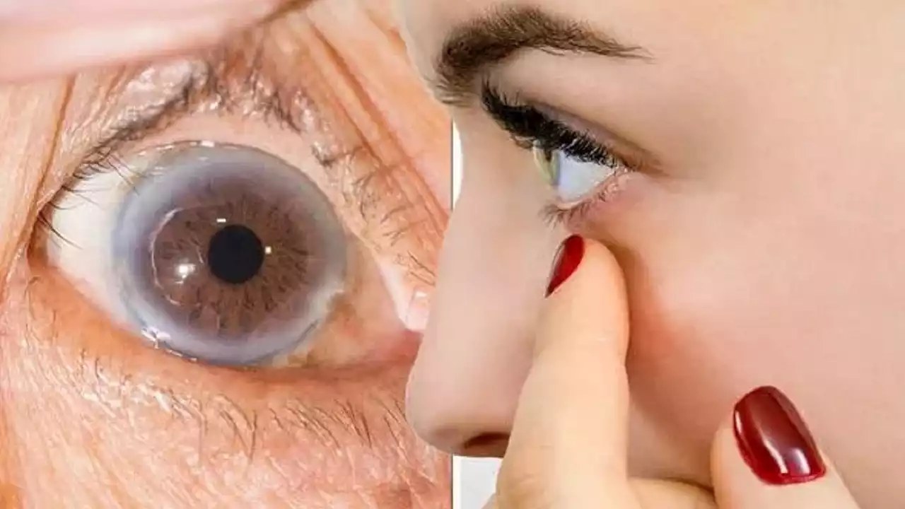 علامات ارتفاع الكوليسترول الضار.. ثلاثة ألوان تحذيرية قد تظهر في العينين !