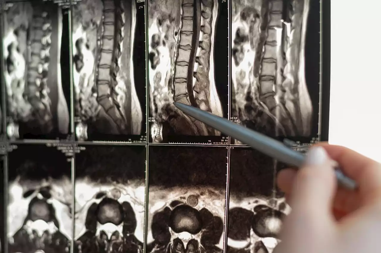 AI discovery could advance the treatment of spinal cord injuries | Engadget