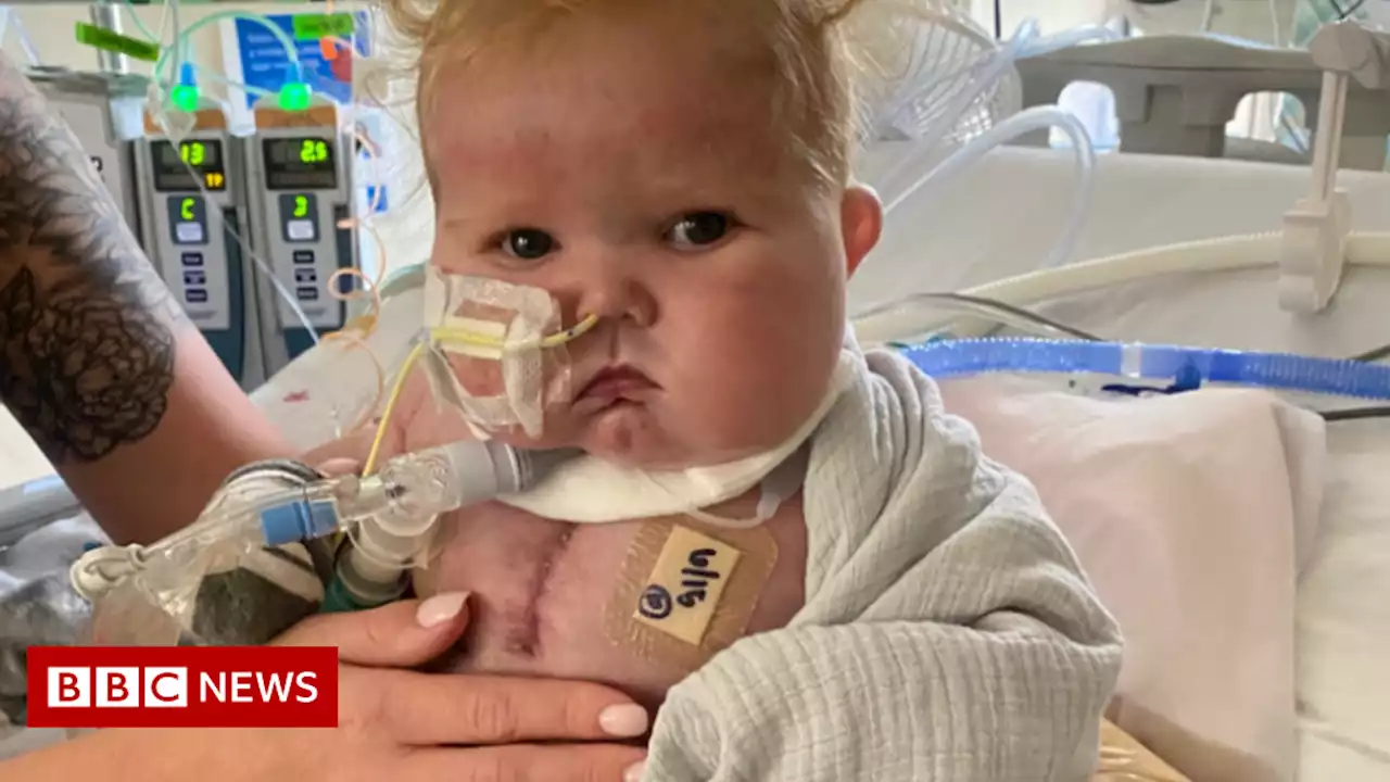 'World-first' heart-thymus transplant success for Easton