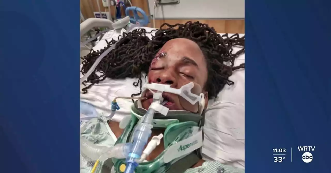 Mother of victim in hit-and-run crash demands justice as her son remains in ICU