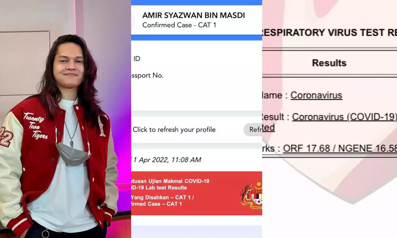 Ini bukan April Fools - Amir Masdi positif Covid-19