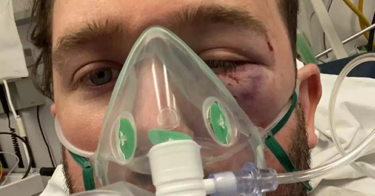 Man has eye socket and bones broken in homophobic attack on Dublin night out