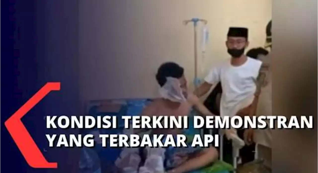 Kondisi Terkini Ali Arisandi, Demontran di Bone yang Tubuhnya Terbakar Api: Sudah Membaik!