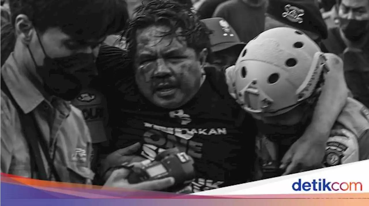 Kondisi Terkini Ade Armando yang Alami Pendarahan Otak-Kandung Kemih