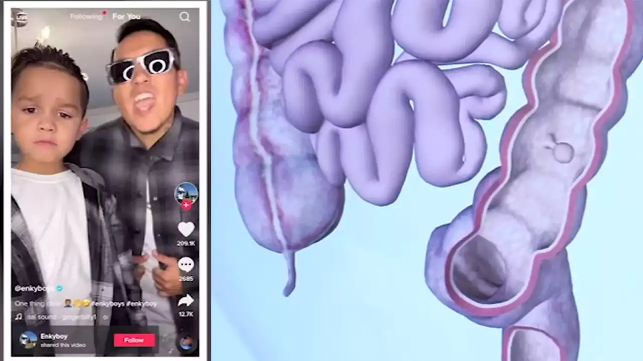 TikTok star diagnosed with colon cancer urges young people to know warning signs: 'Take it serious'