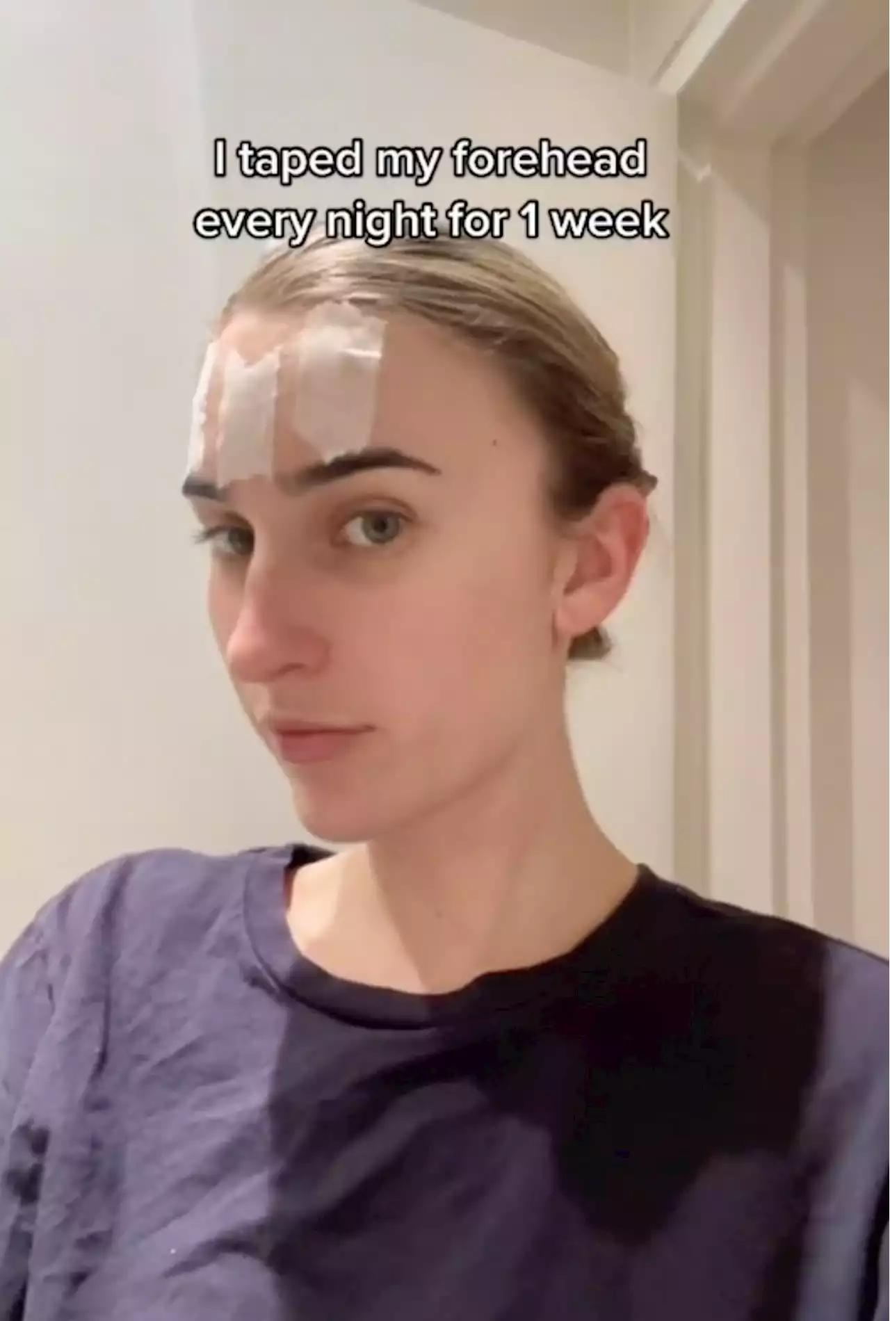 Face Taping is TikTok’s Most Recent Questionable Skin Care Hack